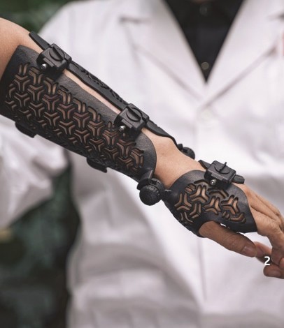 Use of 3D printing orthotics on patient arm for stroke rehabilitation